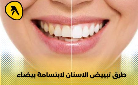 طرق تبييض الاسنان لابتسامة بيضاء.. إليك أفضل العيادات في الكويت